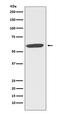Cytochrome B-245 Beta Chain antibody, M00328, Boster Biological Technology, Western Blot image 
