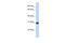 Zinc Finger MYND-Type Containing 19 antibody, 26-560, ProSci, Western Blot image 