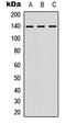 Nuclear Factor Of Activated T Cells 4 antibody, LS-C368441, Lifespan Biosciences, Western Blot image 