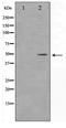 Distal-Less Homeobox 3 antibody, TA347544, Origene, Western Blot image 