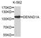 DENN Domain Containing 1A antibody, STJ111799, St John