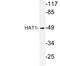 Histone Acetyltransferase 1 antibody, LS-C176520, Lifespan Biosciences, Western Blot image 