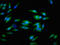 Integrin Subunit Alpha V antibody, LS-C671372, Lifespan Biosciences, Immunofluorescence image 