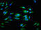 Integrin Alpha V Beta 6 antibody, LS-C671372, Lifespan Biosciences, Immunofluorescence image 