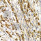 NK-3R antibody, A7220, ABclonal Technology, Immunohistochemistry paraffin image 