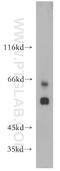 Somatostatin Receptor 1 antibody, 20587-1-AP, Proteintech Group, Western Blot image 