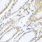 WD Repeat Domain 48 antibody, A07320, Boster Biological Technology, Immunohistochemistry paraffin image 