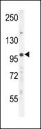 Unk Zinc Finger antibody, 55-612, ProSci, Western Blot image 