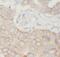 Thymidine Kinase 1 antibody, FNab08718, FineTest, Immunohistochemistry paraffin image 