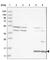 Cytochrome B561 Family Member D1 antibody, HPA027028, Atlas Antibodies, Western Blot image 