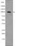 AXL Receptor Tyrosine Kinase antibody, abx148475, Abbexa, Western Blot image 