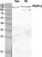 Platelet Derived Growth Factor Receptor Beta antibody, STJ95004, St John