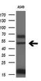 Forkhead Box A2 antibody, GTX84485, GeneTex, Western Blot image 