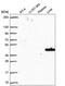 Solute Carrier Family 14 Member 1 (Kidd Blood Group) antibody, PA5-66162, Invitrogen Antibodies, Western Blot image 