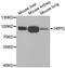 Hexose-6-Phosphate Dehydrogenase/Glucose 1-Dehydrogenase antibody, LS-C334720, Lifespan Biosciences, Western Blot image 