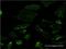Spastin antibody, H00006683-M02, Novus Biologicals, Immunocytochemistry image 