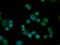 cAMP-specific 3 ,5 -cyclic phosphodiesterase 4A antibody, MA5-25108, Invitrogen Antibodies, Immunocytochemistry image 