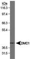 Meiotic recombination protein DMC1/LIM15 homolog antibody, TA301671, Origene, Western Blot image 