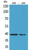 CD84 Molecule antibody, STJ96621, St John