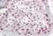 Pescadillo Ribosomal Biogenesis Factor 1 antibody, NB100-1258, Novus Biologicals, Immunohistochemistry paraffin image 