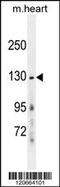 Glutamate Ionotropic Receptor NMDA Type Subunit 2A antibody, 55-788, ProSci, Western Blot image 