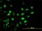 Lysine Acetyltransferase 2B antibody, H00008850-M04, Novus Biologicals, Immunofluorescence image 