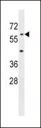 Acyloxyacyl Hydrolase antibody, LS-C159079, Lifespan Biosciences, Western Blot image 