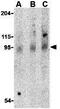 Toll Like Receptor 5 antibody, GTX31724, GeneTex, Western Blot image 