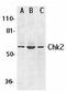 Checkpoint Kinase 2 antibody, TA306063, Origene, Western Blot image 