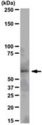 SRC Proto-Oncogene, Non-Receptor Tyrosine Kinase antibody, NBP2-29829, Novus Biologicals, Western Blot image 