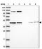 HIF3-alpha antibody, NBP1-89977, Novus Biologicals, Western Blot image 