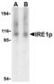 Serine/threonine-protein kinase/endoribonuclease IRE1 antibody, TA306275, Origene, Western Blot image 