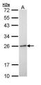 RAB6A, Member RAS Oncogene Family antibody, PA5-22127, Invitrogen Antibodies, Western Blot image 