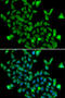 Aspartoacylase antibody, 22-825, ProSci, Immunofluorescence image 