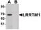 Leucine Rich Repeat Transmembrane Neuronal 1 antibody, PA5-21096, Invitrogen Antibodies, Western Blot image 