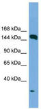 Early Endosome Antigen 1 antibody, TA344445, Origene, Western Blot image 