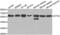 ETS Variant 6 antibody, abx001379, Abbexa, Western Blot image 