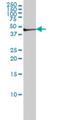 Fibrinogen Gamma Chain antibody, H00002266-M01, Novus Biologicals, Western Blot image 