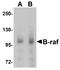 B-Raf Proto-Oncogene, Serine/Threonine Kinase antibody, LS-C115846, Lifespan Biosciences, Western Blot image 