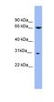 Monoamine Oxidase A antibody, orb330821, Biorbyt, Western Blot image 