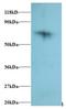 Ribosomal Protein S18 antibody, LS-C211644, Lifespan Biosciences, Western Blot image 