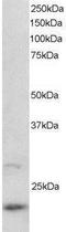 ADP Ribosylation Factor Like GTPase 2 antibody, NB100-1078, Novus Biologicals, Western Blot image 