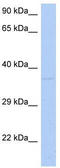 N-Myc Downstream Regulated 1 antibody, TA346583, Origene, Western Blot image 