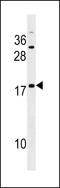 Sperm protein associated with the nucleus on the X chromosome D antibody, LS-C159069, Lifespan Biosciences, Western Blot image 