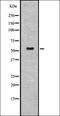 Sonic Hedgehog Signaling Molecule antibody, orb336803, Biorbyt, Western Blot image 