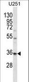 VPS37B Subunit Of ESCRT-I antibody, LS-C160539, Lifespan Biosciences, Western Blot image 