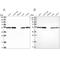 Dynactin Subunit 2 antibody, NBP1-85278, Novus Biologicals, Western Blot image 