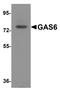 Growth Arrest Specific 6 antibody, PA5-72882, Invitrogen Antibodies, Western Blot image 