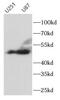 Tyrosine Hydroxylase antibody, FNab10730, FineTest, Western Blot image 