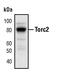 CREB Regulated Transcription Coactivator 2 antibody, PA5-17437, Invitrogen Antibodies, Western Blot image 